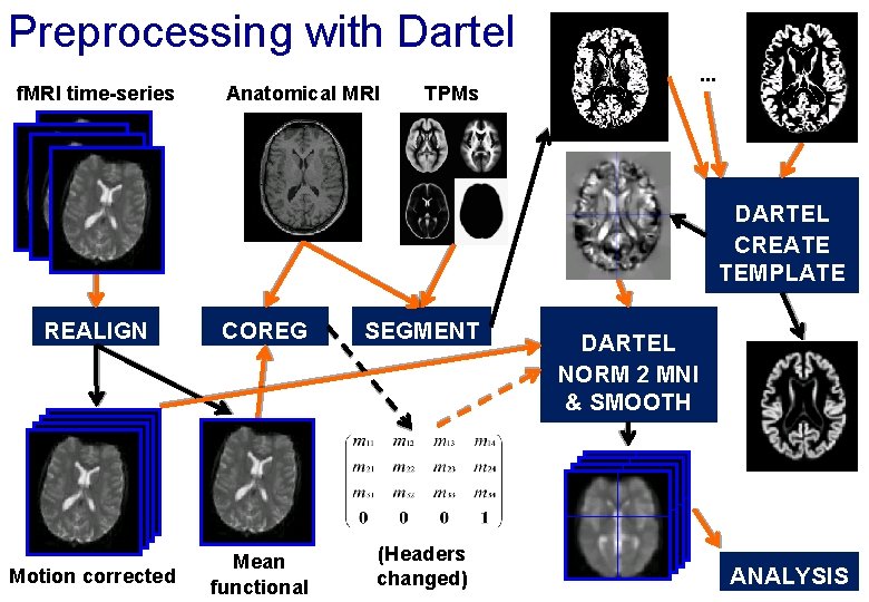 Preprocessing with Dartel f. MRI time-series Anatomical MRI . . . TPMs DARTEL CREATE