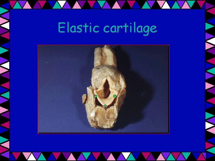 Elastic cartilage 