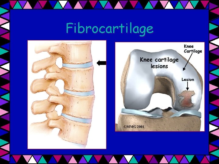 Fibrocartilage 