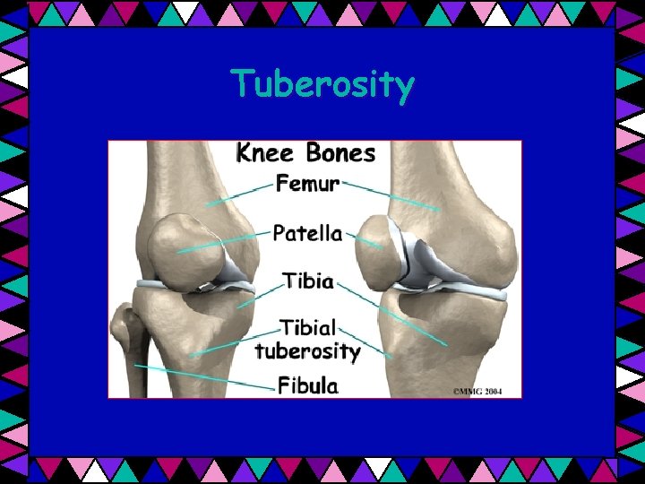 Tuberosity 