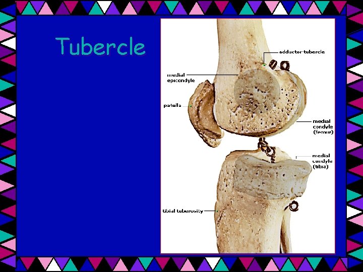 Tubercle 