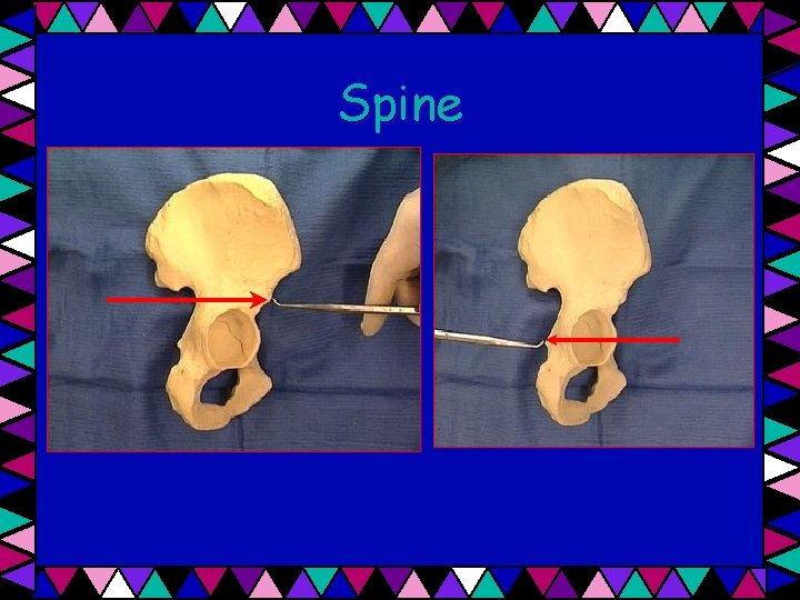 Spine 