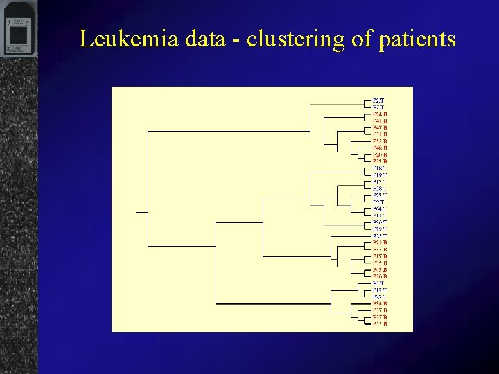 Leukemia data - clustering of patients 