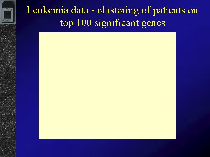 Leukemia data - clustering of patients on top 100 significant genes 