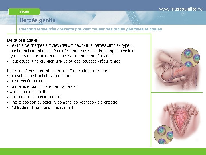 Virale www. masexualite. ca Herpès génital Infection virale très courante pouvant causer des plaies