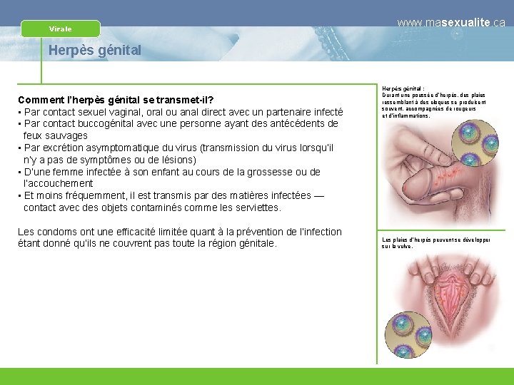Virale www. masexualite. ca Herpès génital Comment l’herpès génital se transmet-il? • Par contact