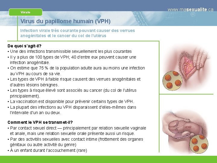 Virale Virus du papillome humain (VPH) Infection virale très courante pouvant causer des verrues