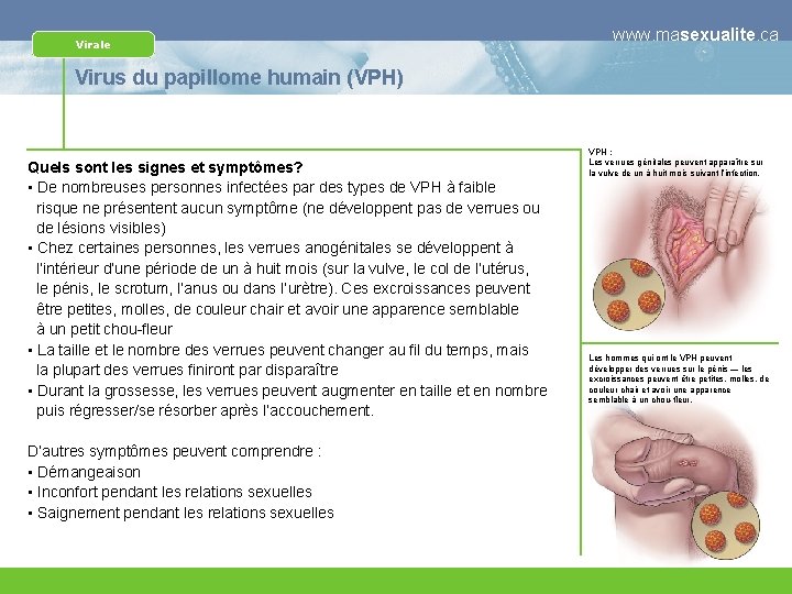 Virale www. masexualite. ca Virus du papillome humain (VPH) Quels sont les signes et