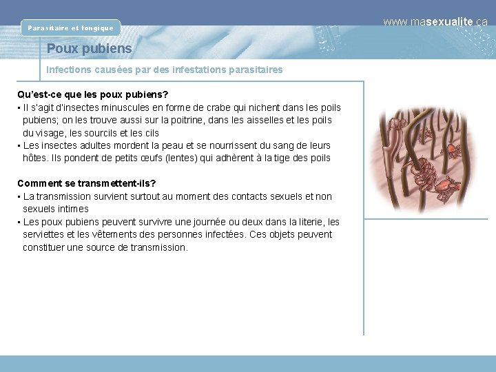 Parasitaire et fongique Poux pubiens Infections causées par des infestations parasitaires Qu’est-ce que les