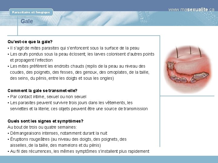Parasitaire et fongique Gale Qu’est-ce que la gale? • Il s’agit de mites parasites