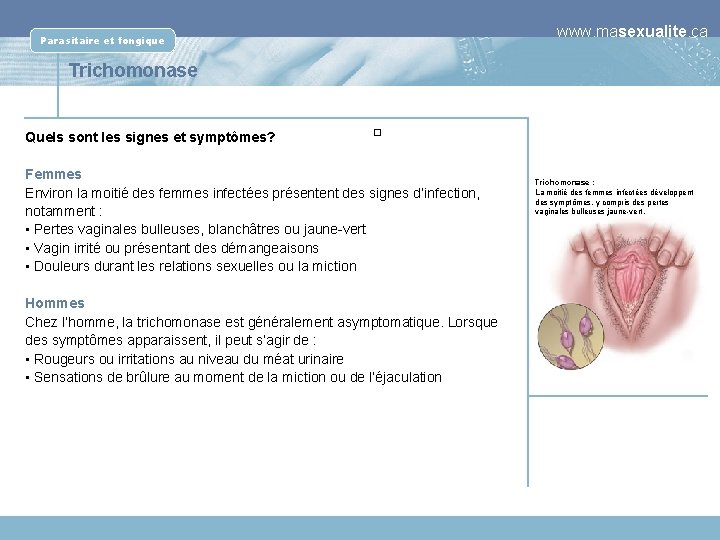 www. masexualite. ca Parasitaire et fongique Trichomonase Quels sont les signes et symptômes? �