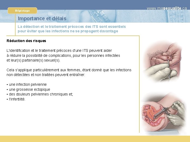 Dépistage Importance et délais La détection et le traitement précoces des ITS sont essentiels
