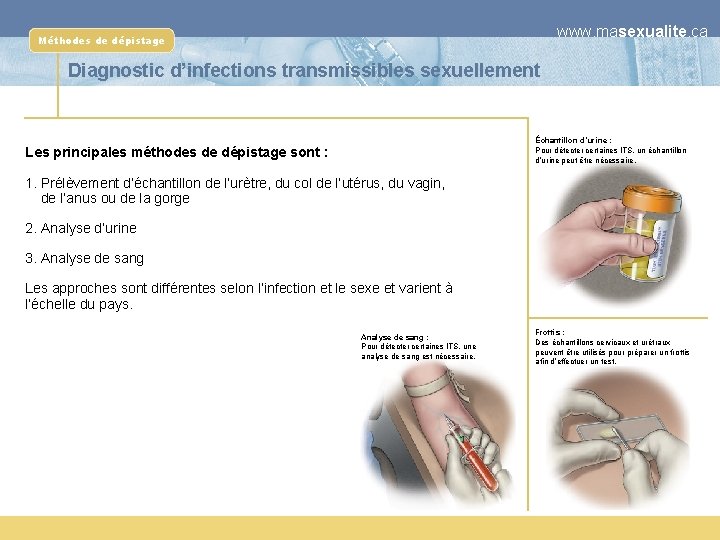 www. masexualite. ca Méthodes de dépistage Diagnostic d’infections transmissibles sexuellement Échantillon d’urine : Pour