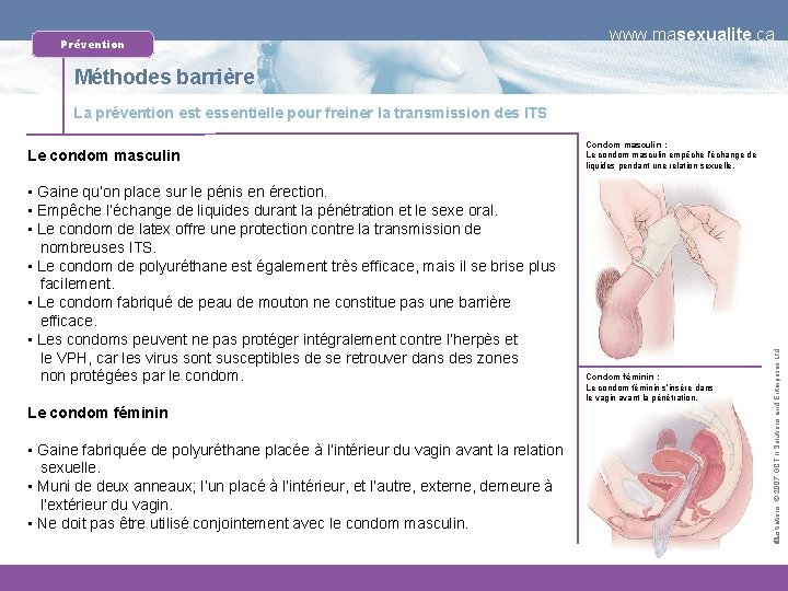 Prévention www. masexualite. ca Méthodes barrière La prévention est essentielle pour freiner la transmission