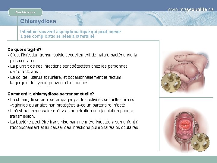 Bactérienne Chlamydiose Infection souvent asymptomatique qui peut mener à des complications liées à la