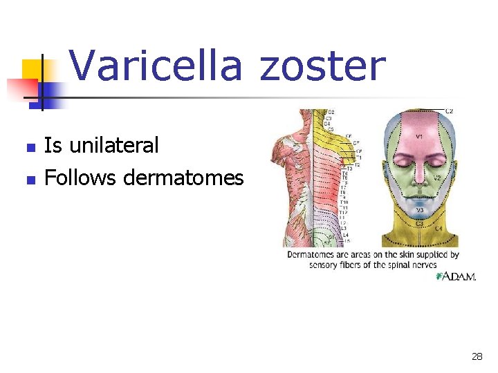 Varicella zoster n n Is unilateral Follows dermatomes 28 