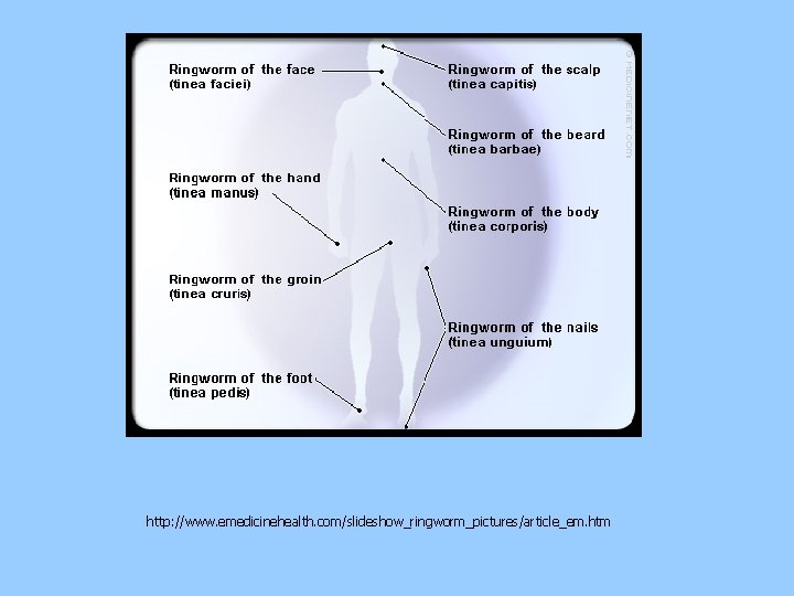 http: //www. emedicinehealth. com/slideshow_ringworm_pictures/article_em. htm 
