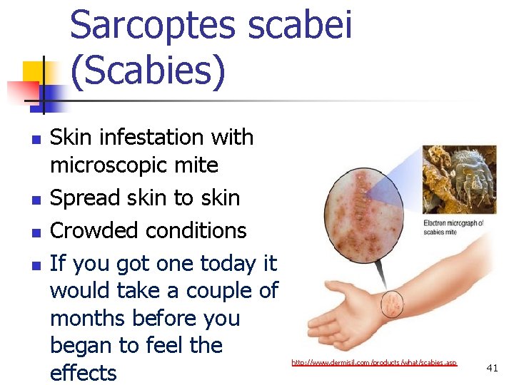 Sarcoptes scabei (Scabies) n n Skin infestation with microscopic mite Spread skin to skin
