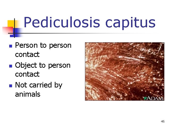 Pediculosis capitus n n n Person to person contact Object to person contact Not