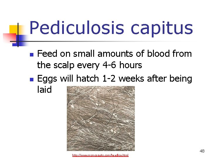 Pediculosis capitus n n Feed on small amounts of blood from the scalp every