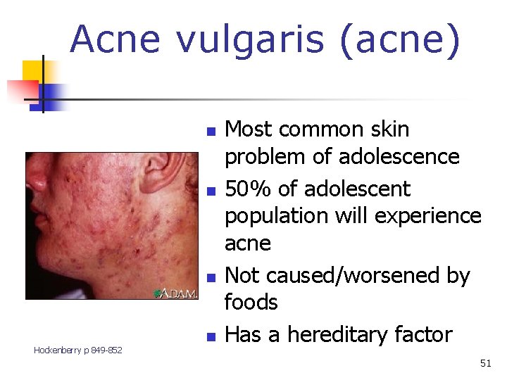 Acne vulgaris (acne) n n n Hockenberry p 849 -852 n Most common skin