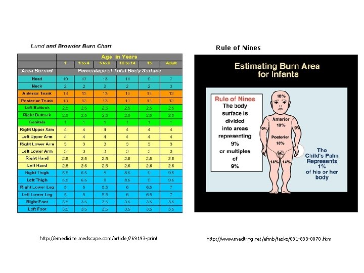 Rule of Nines http: //emedicine. medscape. com/article/769193 -print http: //www. medtrng. net/efmb/tasks/081 -833 -0070.