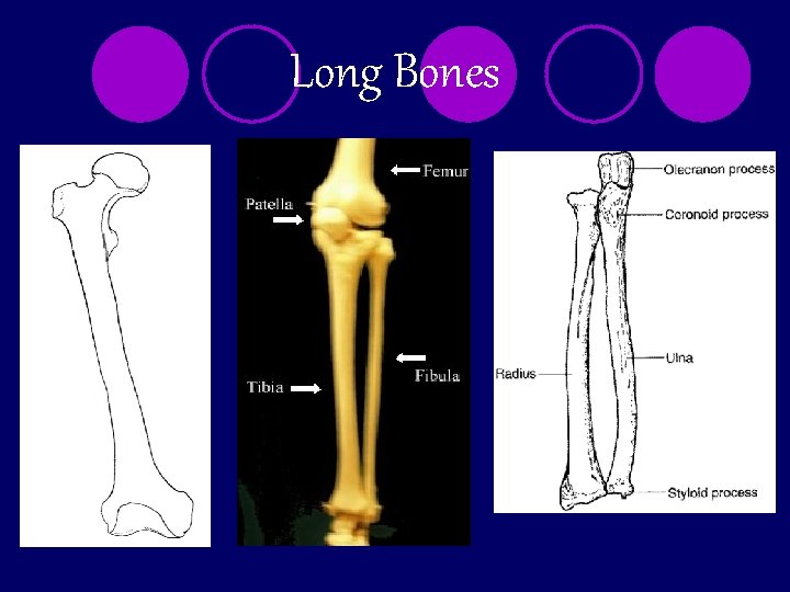 Long Bones 