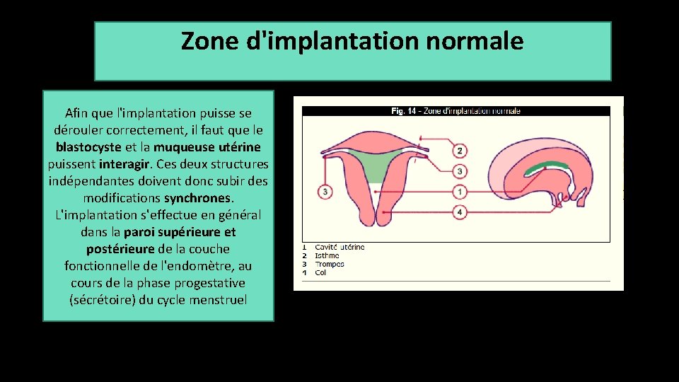 Zone d'implantation normale Afin que l'implantation puisse se dérouler correctement, il faut que le