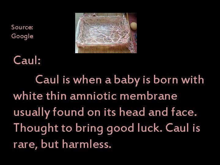 Source: Google Caul: Caul is when a baby is born with white thin amniotic