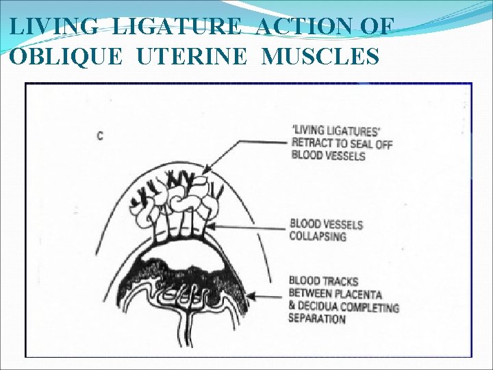 THIRD STAGE OF LABOUR DEFINITION Third stage is