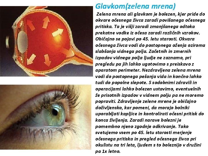 Glavkom(zelena mrena) Zelena mrena ali glavkom je bolezen, kjer pride do okvare očesnega živca
