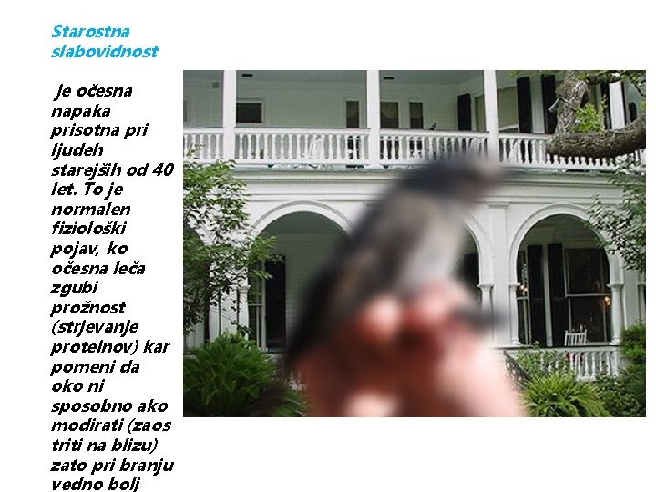 Starostna slabovidnost je očesna napaka prisotna pri ljudeh starejših od 40 let. To je