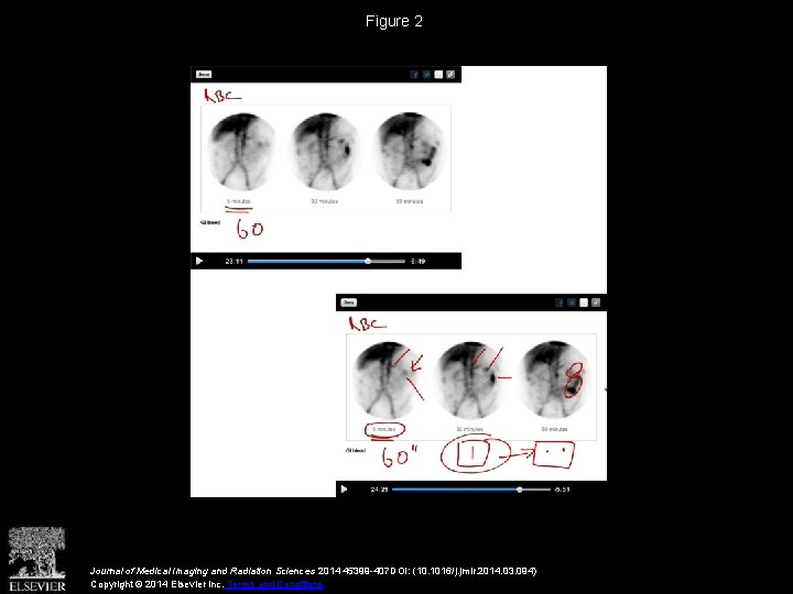 Figure 2 Journal of Medical Imaging and Radiation Sciences 2014 45399 -407 DOI: (10.