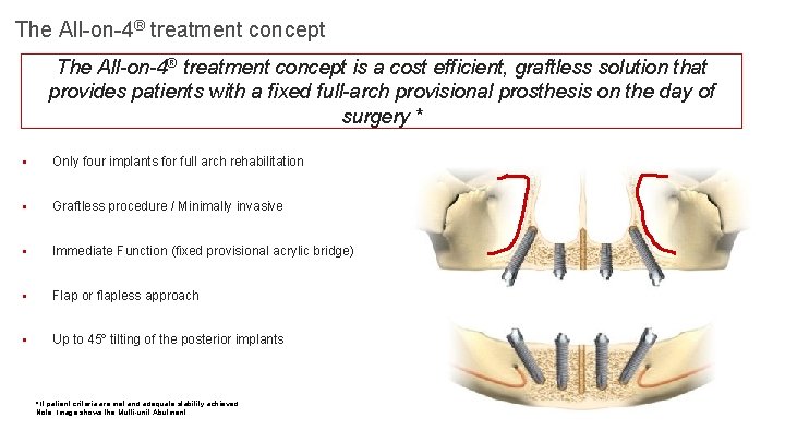The All-on-4® treatment concept is a cost efficient, graftless solution that provides patients with