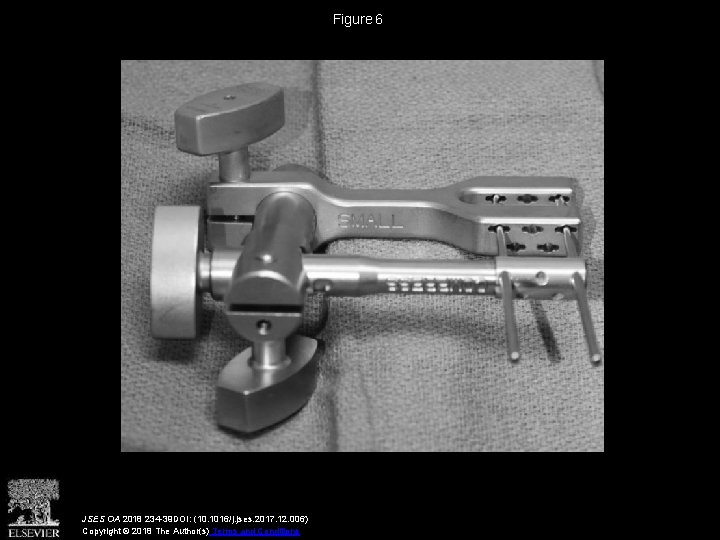 Figure 6 JSES OA 2018 234 -39 DOI: (10. 1016/j. jses. 2017. 12. 006)