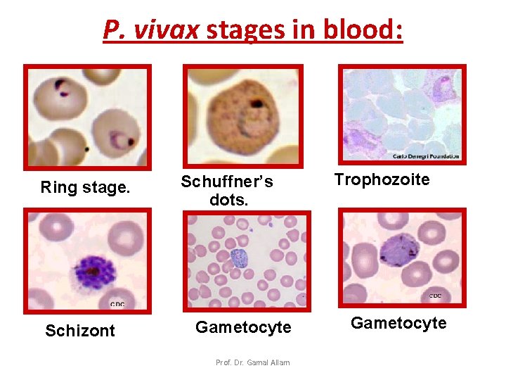 P. vivax stages in blood: Ring stage. Schizont Schuffner’s dots. Gametocyte Prof. Dr. Gamal