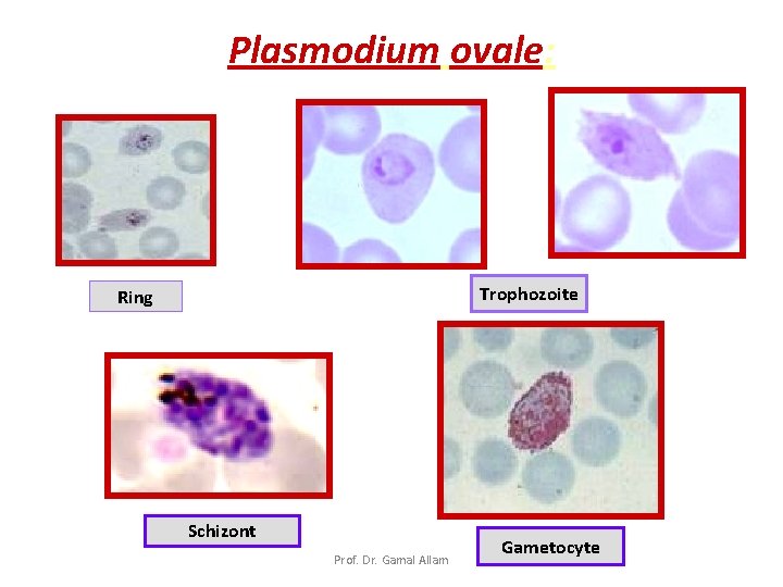 Plasmodium ovale: Trophozoite Ring Schizont Prof. Dr. Gamal Allam Gametocyte 