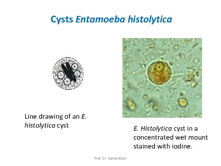 Cysts Entamoeba histolytica Line drawing of an E. histolytica cyst E. Histolytica cyst in