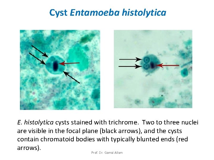 Cyst Entamoeba histolytica E. histolytica cysts stained with trichrome. Two to three nuclei are