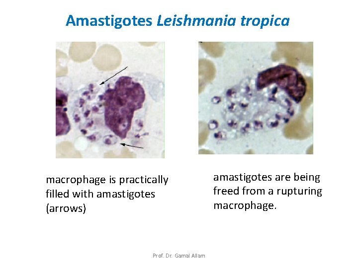 Amastigotes Leishmania tropica macrophage is practically filled with amastigotes (arrows) Prof. Dr. Gamal Allam