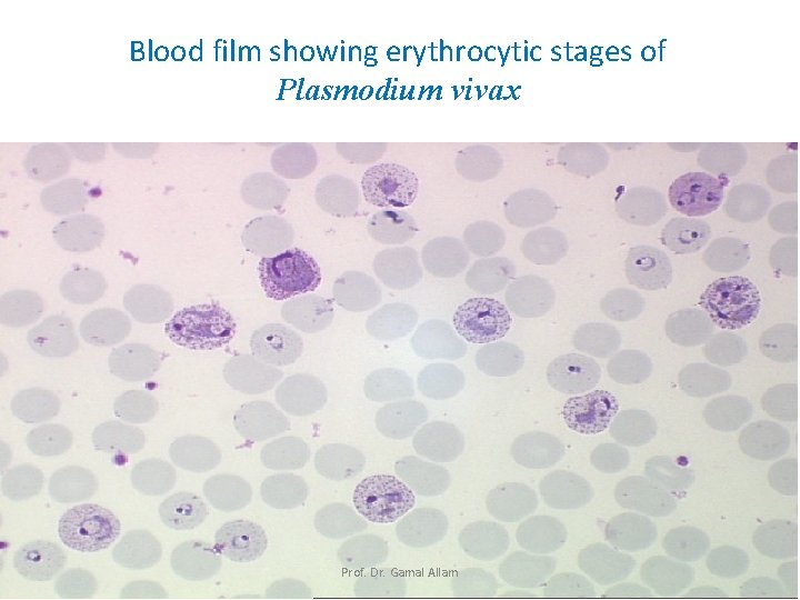 Blood film showing erythrocytic stages of Plasmodium vivax Prof. Dr. Gamal Allam 