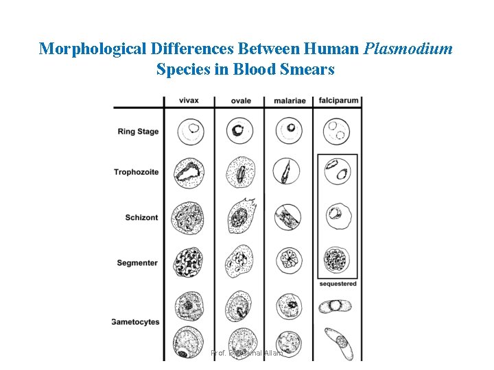 Morphological Differences Between Human Plasmodium Species in Blood Smears Prof. Dr. Gamal Allam 