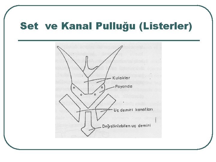 Set ve Kanal Pulluğu (Listerler) 