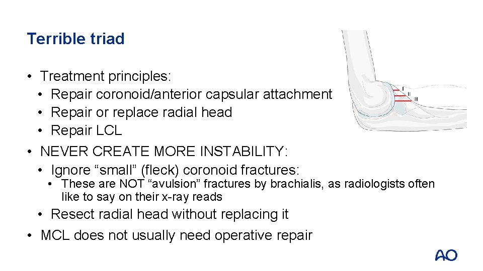 Terrible triad • Treatment principles: • Repair coronoid/anterior capsular attachment • Repair or replace