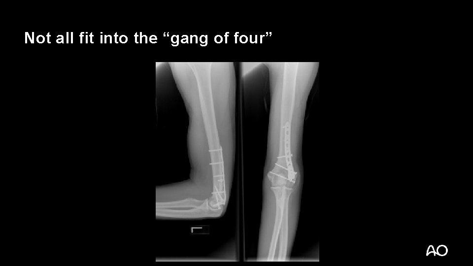 Not all fit into the “gang of four” 