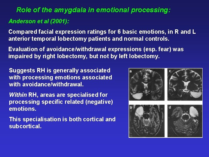 Role of the amygdala in emotional processing: Anderson et al (2001): Compared facial expression