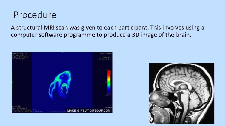 Procedure A structural MRI scan was given to each participant. This involves using a