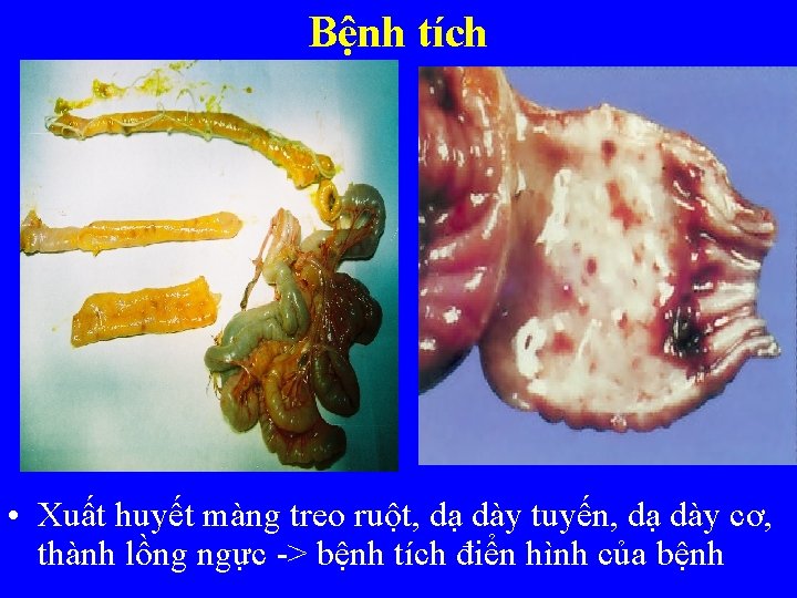 Bệnh tích • Xuất huyết màng treo ruột, dạ dày tuyến, dạ dày cơ,