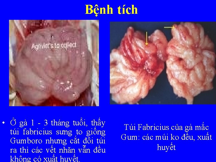 Bệnh tích • Ở gà 1 - 3 tháng tuổi, thấy túi fabricius sưng