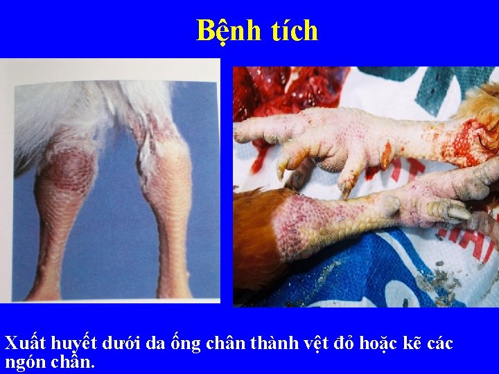 Bệnh tích Xuất huyết dưới da ống chân thành vệt đỏ hoặc kẽ các